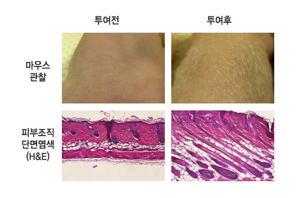 모낭조직 분화를 촉진하는 제대혈 줄기세포 분비 단백질을 이용한 탈모 방지 및 발모용 의약품 개발